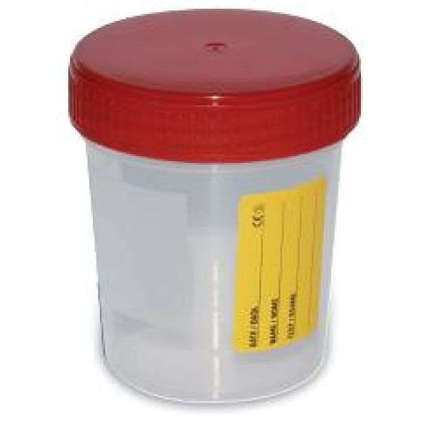 contenitore-sterile-urina-15612
